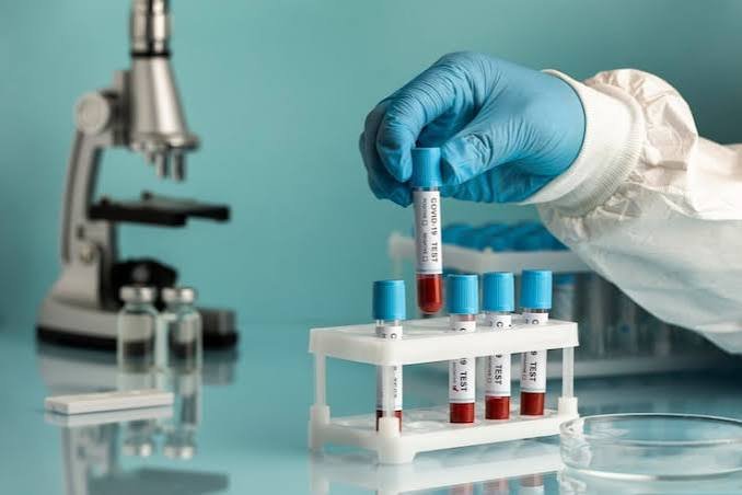 Lab Tests